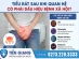 Tiểu Rát Sau Khi Quan Hệ Có Phải Dấu Hiệu Bệnh Xã Hội? Chuyên Gia Giải Đáp