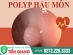 Tổng Hợp Các Cách Chữa Trị Polyp Hậu Môn Nhanh Chóng