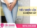 Tiểu Nhiều Lần Kéo Dài Là Bị Gì? Khi Nào Cần Thăm Khám