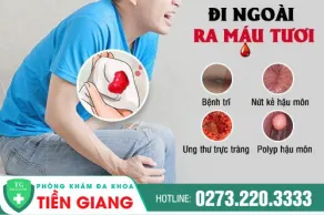 Đi Cầu Ra Máu Điều Trị Ở Đâu Tốt?