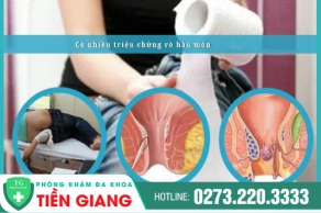 Tổng Hợp Các Triệu Chứng Rò Hậu Môn