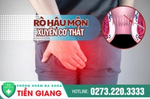 Rò Hậu Môn Xuyên Cơ Thắt Chớ Nên Chủ Quan Nên Chủ Động Thăm Khám Và Điều Trị Sớm