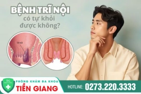 Trĩ Nội Có Tự Khỏi Được Không? Cùng Bác Sĩ Chuyên Khoa Tìm Hiểu Bệnh Trĩ Nội Nên Điều Trị Thế Nào Nhé