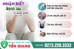 Dấu hiệu bệnh lậu ở nam - Tác hại và cách điều trị như thế nào?