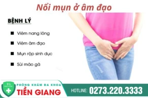 Tại sao cô bé bị nổi mụn? Cách điều trị hiệu quả