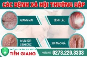 Bệnh xã hội là bệnh gì? Cách điều trị thế nào hiệu quả?