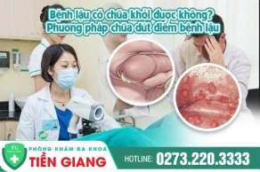 Bệnh Lậu Có Chữa Khỏi Được Không ? Chữa Bằng Cách Nào