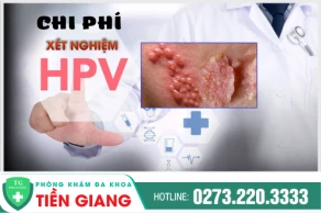 Chí Phí Xét Nghiệm Sùi Mào Gà Là Bao Nhiêu ? Ở Đâu ?