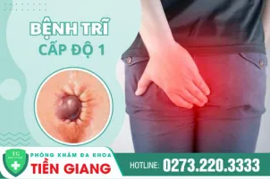 tri-cap-do-1-co-nhung-bieu-hien-gi-cach-chua-tri-benh-tri-cap-do-1-970