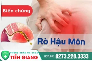 mo-ro-hau-mon-phuong-phap-va-chi-phi-147