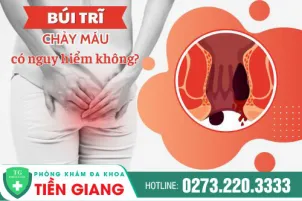 bui-tri-bi-chay-mau-co-nguy-hiem-khong-dieu-tri-ra-sao-992