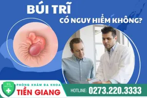 bui-tri-la-gi-tac-hai-va-cach-dieu-tri-945