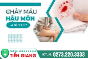 chay-mau-hau-mon-nguyen-nhan-va-cach-chua-tri-78
