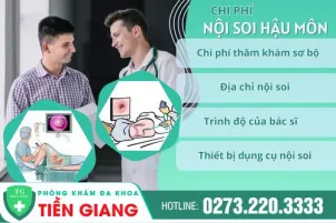 phuong-phap-noi-soi-hau-mon-va-chi-phi-noi-soi-duoc-cap-nhat-moi-985