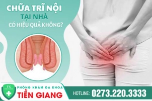 mach-cac-cach-tri-tri-noi-tai-nha-hieu-qua-923