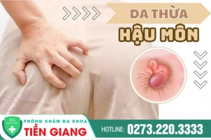 tim-hieu-cach-khac-phuc-da-thua-hau-mon-1017