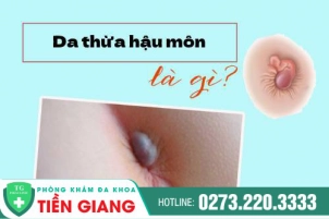 da-thua-o-hau-mon-co-chua-duoc-chi-phi-dieu-tri-bao-nhieu-1013