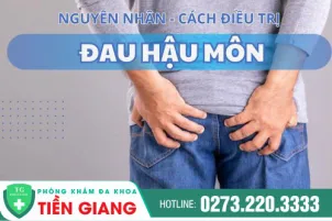 tham-khao-ngay-cac-cach-chua-hau-mon-bi-dau-ngay-nao-1009