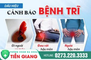 cung-bac-si-chuyen-khoa-tim-hieu-benh-tri-la-gi-va-bieu-hien-khi-mac-benh-ly-nhe-220