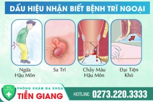benh-tri-ngoai-la-gi-nguyen-nhan-mac-tri-ngoai-va-cac-phuong-phap-dieu-tri-hieu-qua-1379