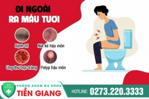 xem-ngay-cac-ly-do-de-biet-di-cau-ra-mau-la-bi-gi-1036