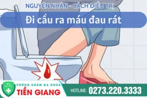 dau-hieu-di-ve-sinh-ra-mau-va-dau-rat-hau-mon-la-benh-ly-gi-1039