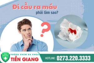 top-cac-cach-tri-di-cau-ra-mau-tai-nha-994