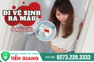di-ve-sinh-ra-mau-o-nu-gioi-nen-lam-sao-co-anh-huong-gi-1024