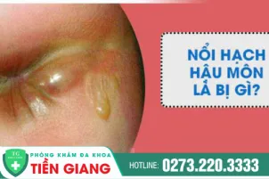 hach-hau-mon-la-gi-co-nguy-hiem-khong-1011