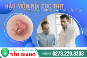 hau-mon-co-dau-hieu-noi-cuc-bao-hieu-suc-khoe-dang-gap-van-de-988