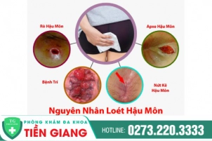 loet-hau-mon-dau-hieu-cua-benh-gi-co-gay-nguy-hiem-620