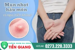 mun-nhot-hau-mon-bi-be-co-nguy-hiem-khong-nen-dieu-tri-khi-phat-hien-som-955