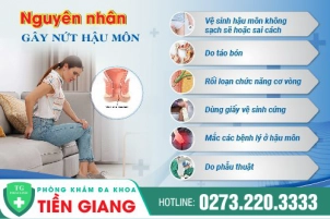 tong-quan-ve-nut-ke-hau-mon-29