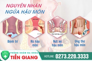 trieu-chung-ngua-hau-mon-pho-bien-thuong-gap-la-gi-khac-phuc-nhu-the-nao-624