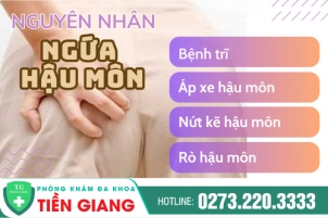 nguyen-nhan-va-cach-chua-ngua-hau-mon-tim-hieu-ngay-nhe-626