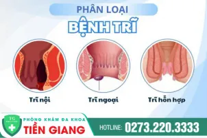 cac-giai-doan-va-bieu-hien-tung-giai-doan-cua-benh-tri-937