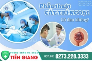 phau-thuat-cat-tri-ngoai-co-dau-khong-co-can-nam-vien-khong-978