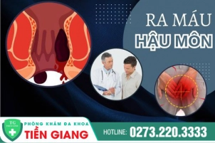 ra-mau-hau-mon-dau-hieu-bao-benh-cho-nen-chu-quan-nhe-1014