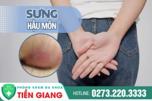 hau-mon-sung-dau-cach-chua-hieu-qua-1016