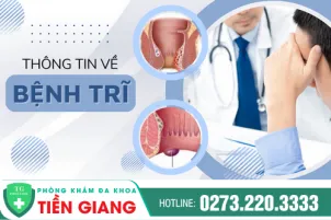 nhu-the-nao-la-bi-tri-bieu-hien-trieu-chung-phuong-phap-dieu-tri-ra-sao-947