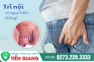 cat-tri-noi-co-dau-khong-co-bi-tai-phat-lai-930
