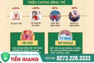 nhu-the-nao-la-benh-tri-phuong-thuc-dieu-tri-ra-sao-938