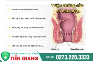 mo-ro-hau-mon-o-dau-tot-tai-tien-giang-607