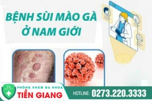 noi-mun-vung-kin-nam-canh-bao-dau-hieu-benh-nguy-hiem-1421