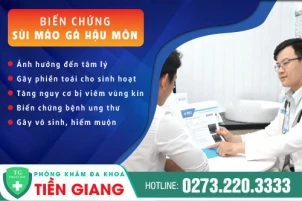 chua-chua-sui-mao-ga-o-hau-mon-nhu-the-nao-cho-hieu-qua-chi-phi-het-bao-nhieu-1087