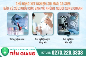 tai-sao-can-xet-nghiem-sui-mao-ga-dia-chi-xet-nghiem-sui-mao-ga-uy-tin-1315