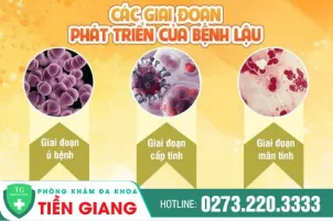 hien-tuong-benh-lau-xuat-hien-o-vung-kin-1062
