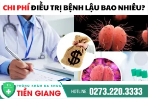cap-nhat-bang-gia-moi-ve-dieu-tri-benh-lau-1057