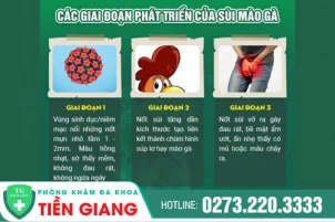 nhung-dau-hieu-cho-thay-ban-dang-mac-benh-sui-mao-ga-va-cach-dieu-tri-1325