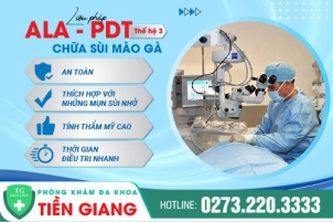 tri-hau-mon-noi-mun-thit-tien-giang-phan-loai-va-nguyen-nhan-gay-ra-la-gi-1413